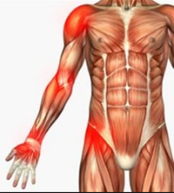 Remédio caseiro para dores musculares e nas articulações
